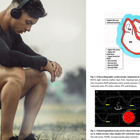 Athlete's Heart: Why Do Athletes' Hearts Grow Bigger?