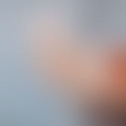 Tennis Elbow (Lateral Epicondylitis)