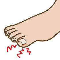 爪の悩み