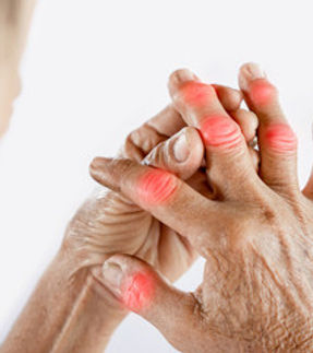 ARTHRITIS.jpg