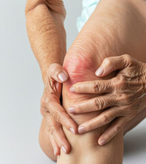 OSTEOARTHRITIS.jpg
