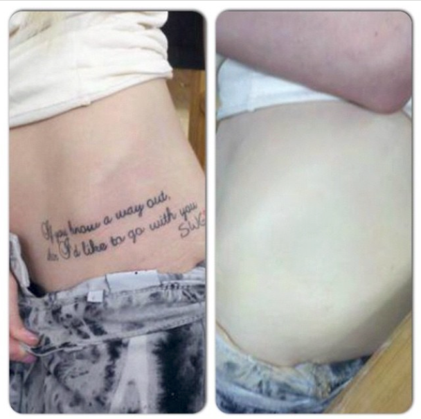 Tattoo Coverage