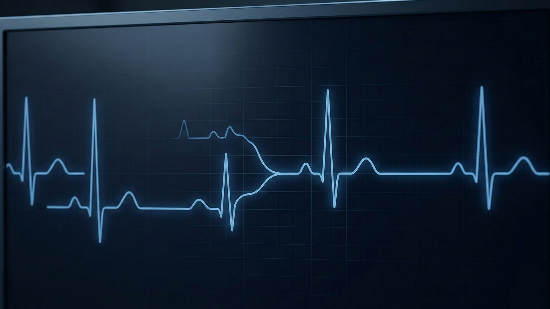 S|B Engine case study illustration - The Unified Pulse