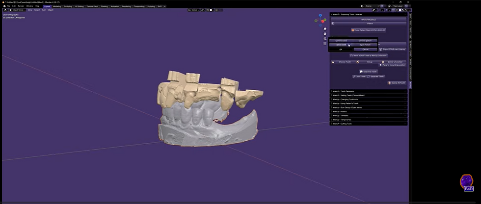 Showing the B4D interface with models categorized into Working Models, Antagonist, and Teeth collections.