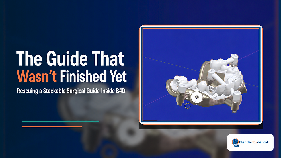 The Guide That Wasn’t Finished Yet: Rescuing a Stackable Surgical Guide Inside B4D