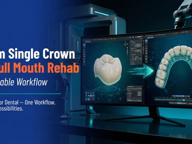From Single Crown to Full Mouth Rehab: A Scalable Workflow