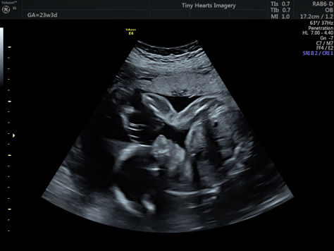 Navigating Pregnancy Week by Week: Essential Insights for Expecting Families from Tiny Hearts 4D Ultrasound