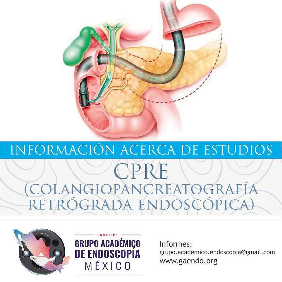 CPRE (colangiopancreatografía retrógrada endoscópica)