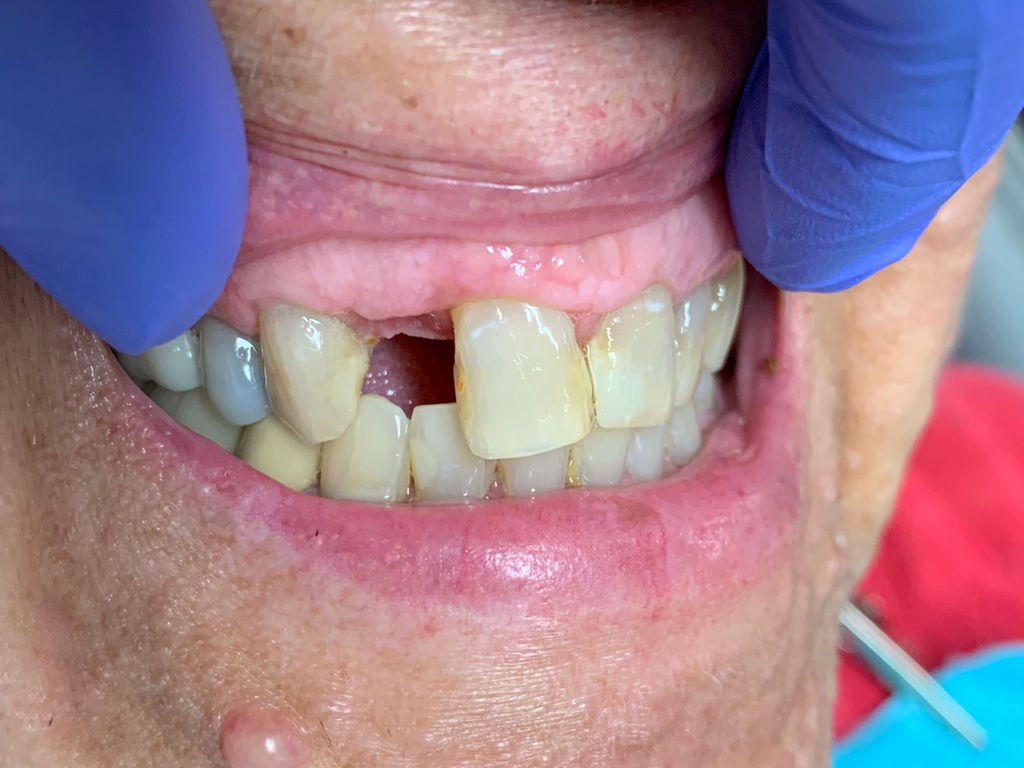 Dentist Dayton Dental Group Dayton