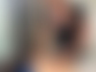 What is Cupping Therapy?