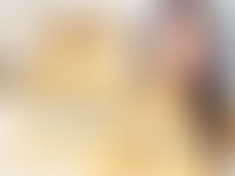 唇毛生長點算？詳解唇毛生長原因、脫唇毛方法及激光脫唇毛服務比較！