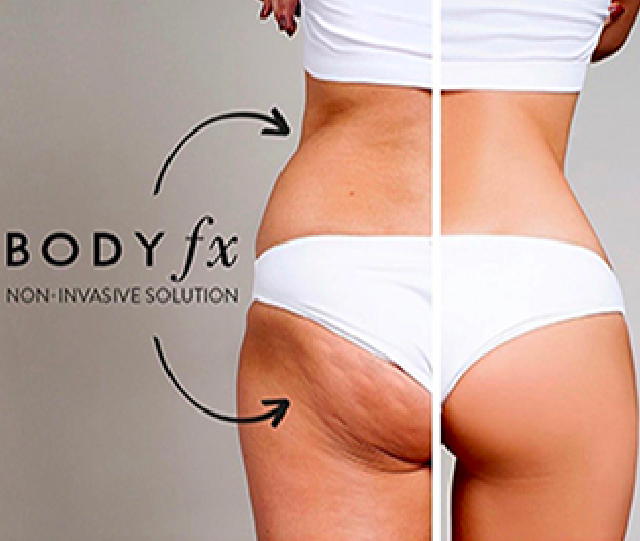 Body Fx
