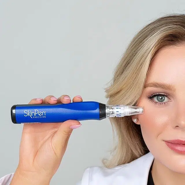 microneedlingskinpen.webp