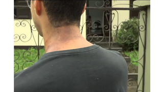 Dezenas de estudantes sofrem queimaduras durante trote em Palotina