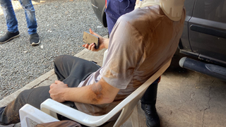 Condutor de motocicleta fica ferido ao desviar de cachorro e sofrer queda