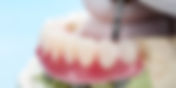 Top Reasons to Choose EZ Dental Care for Implant-Supported Dentures