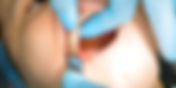 Top Reasons to Choose EZ Dental Care for Wisdom Tooth Extraction