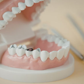 how much do dental implants cost