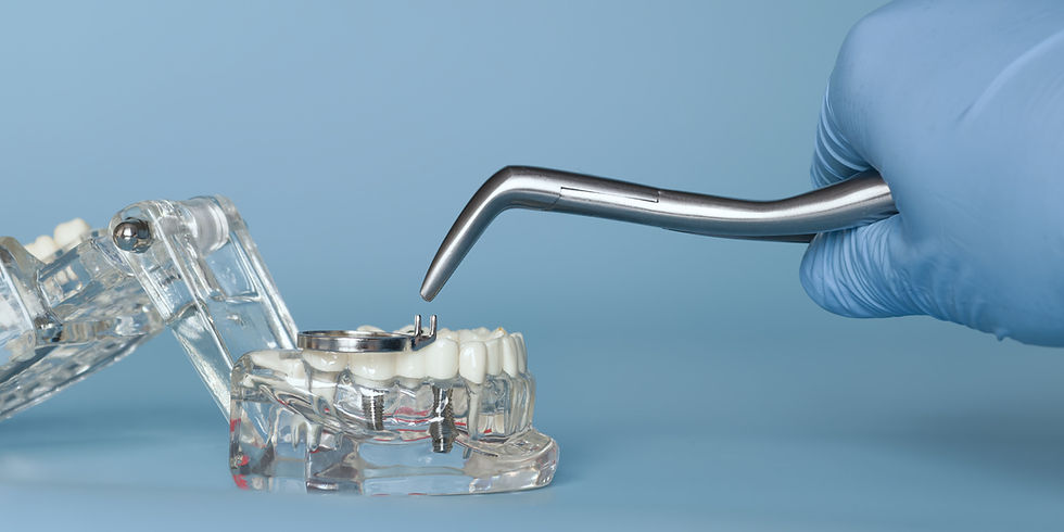  dental implants cost