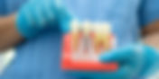 Top Reasons to Choose EZ Dental Care for Dental Implants