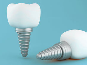 dental implant failure