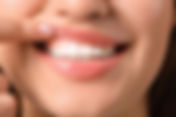 How Much Is Gum Grafting in Singapore?