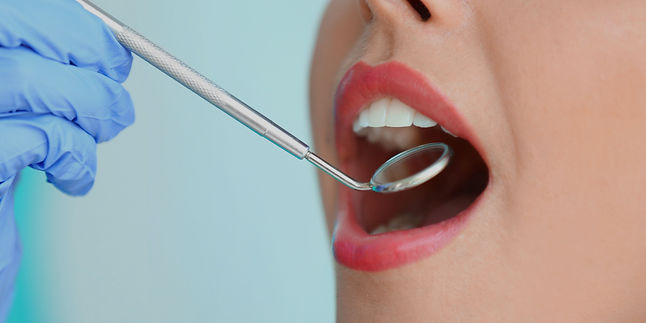 Dental Scaling and Polishing (2).jpg