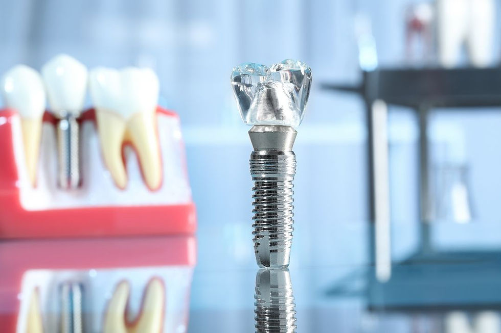 dental implants procedure