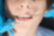 Typical Duration of Dental Scaling and Polishing in Singapore