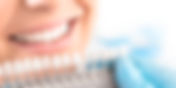 Top Reasons to Choose EZ Dental Care for Teeth Whitening