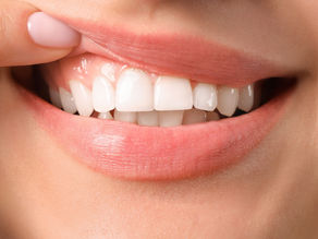 dental tissue graft