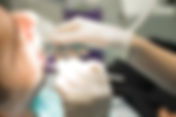 Dental Scaling and Polishing Price in Singapore: A Complete Guide
