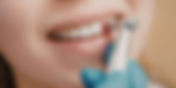 Top 5 Benefits of Dental Scaling and Polishing for a Healthier Smile