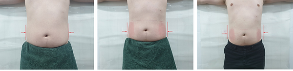 Pherapy Immediate Body Size Reduction Data