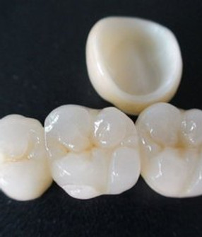 zirconia-crown-250x250.jpg