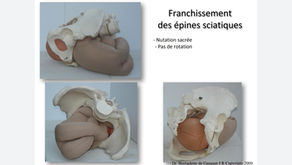 分娩体位：ある産婦人科医の感想