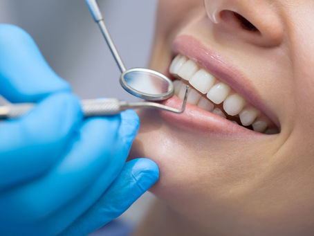 What Are Porcelain Crowns: Benefits, Procedure, And Aftercare?