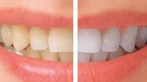 How Orthodontics In New York Caters To All Ages?