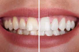 What Are Kids' Typical Dental Problems, And How Can Pediatric Dentists Effectively Treat Them?