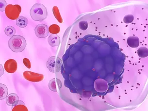 IRAKLIA Study - Intravenous Isatuximab vs Subcutaneous Isatuximab