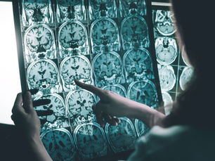 FDA approves blood test for the diagnosis of Alzheimer’s Disease