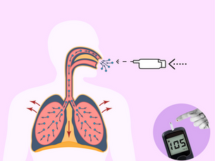 Afrezza® inhaled insulin is approved for diabetes management