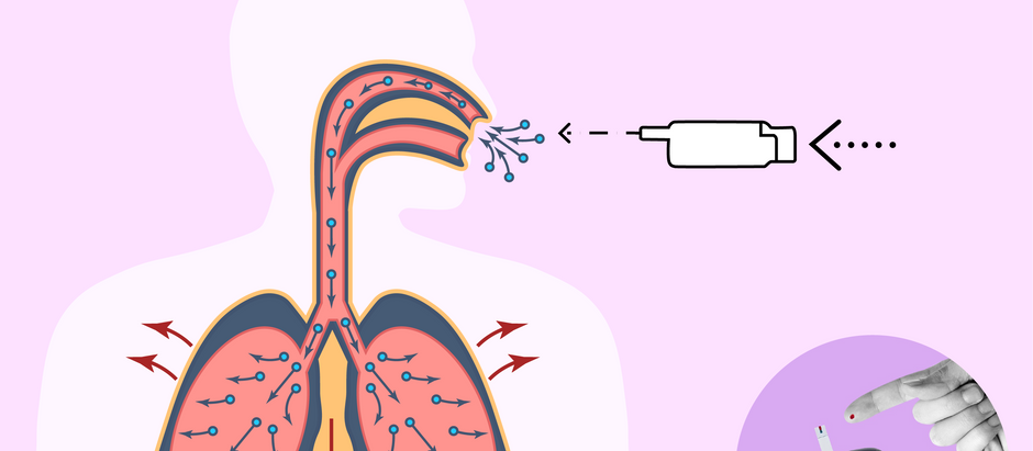 Afrezza® inhaled insulin is approved for diabetes management