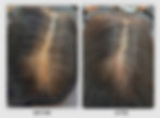 Scalp SMP Case 2