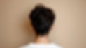 male-scalp-2.jpg
