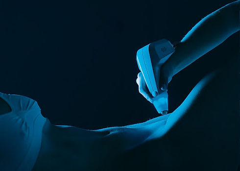 Exilis_Intima.jpg