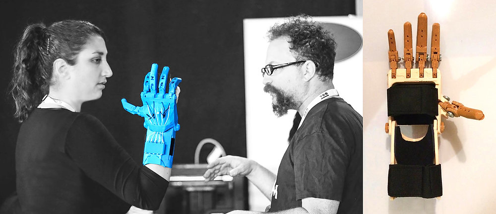 Protesing Hand My Two Cents on Prosthetic Hands