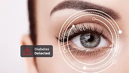 Image of eye being analyzed with text shoeing diabetes was detected.