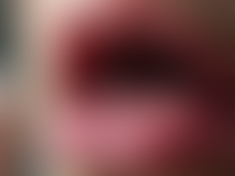 Understanding Throat Discomfort Causes and Symptoms