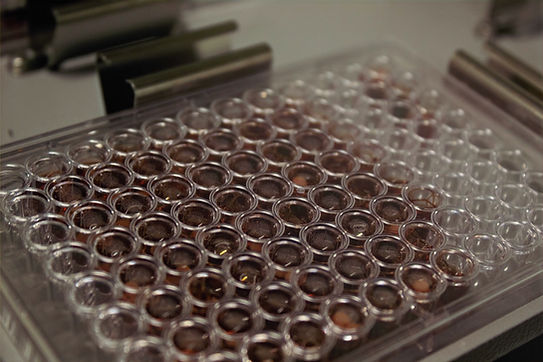 96 well plate of eluted DBS punches.